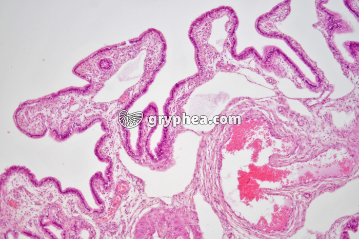 Trompe de Fallope x25 - gryphea.com